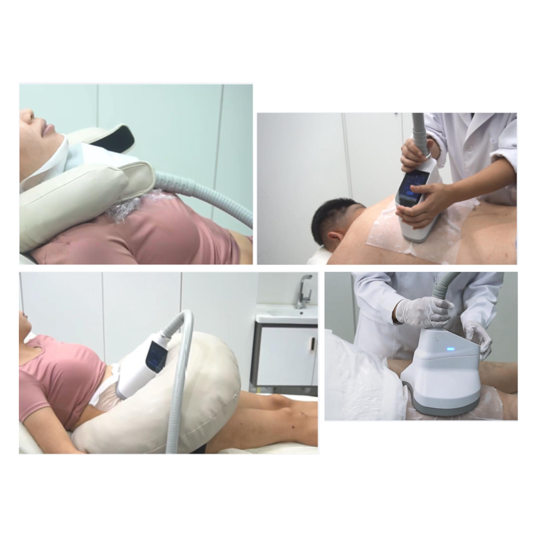 Cryo FrozenCell PRO 360° 3v1 - Kryolipolýza + RF + Kavitácia s Android systémom - Image 8